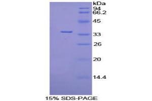 Image no. 1 for Pyruvate Dehydrogenase Kinase, Isozyme 4 (PDK4) protein (ABIN3011410)