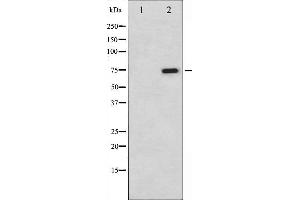Image no. 4 for anti-V-Raf-1 Murine Leukemia Viral Oncogene Homolog 1 (RAF1) (pSer259) antibody (ABIN6256220)