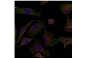 Image no. 2 for anti-Family with Sequence Similarity 129, Member A (FAM129A) (AA 908-920) antibody (ABIN197598)