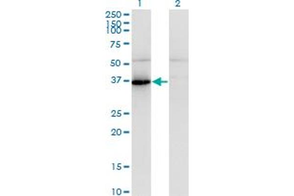 anti-Pantothenate Kinase 1 (PANK1) (AA 310-409) antibody