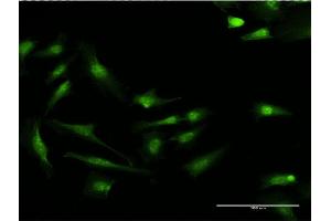 Immunofluorescence of monoclonal antibody to S100P on HeLa cell.