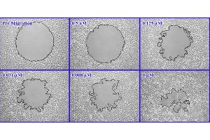 Image no. 1 for Radius™ 24-Well Cell Migration Assay (ABIN2344873)
