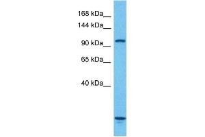 Image no. 8 for anti-Aconitase 1 (ACO1) (N-Term) antibody (ABIN2778793)