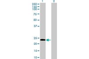 Image no. 1 for anti-Ephrin A2 (EFNA2) (AA 1-213) antibody (ABIN515178)