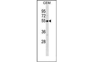 Image no. 2 for anti-Retinoblastoma Binding Protein 7 (RBBP7) (AA 190-219), (Middle Region) antibody (ABIN954472)