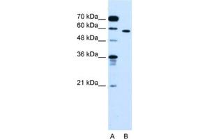 Image no. 1 for anti-Oxysterol Binding Protein-Like 9 (OSBPL9) antibody (ABIN2462875)
