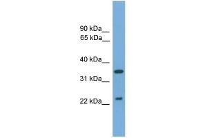 Image no. 1 for anti-WNT Inhibitory Factor 1 (WIF1) (N-Term) antibody (ABIN2784868)