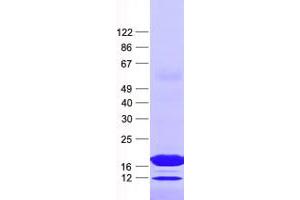 NUDT6 Protein (His tag)