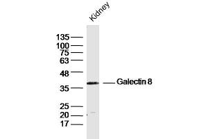 Image no. 1 for anti-Lectin, Galactoside-Binding, Soluble, 8 (LGALS8) (AA 281-359) antibody (ABIN758636)