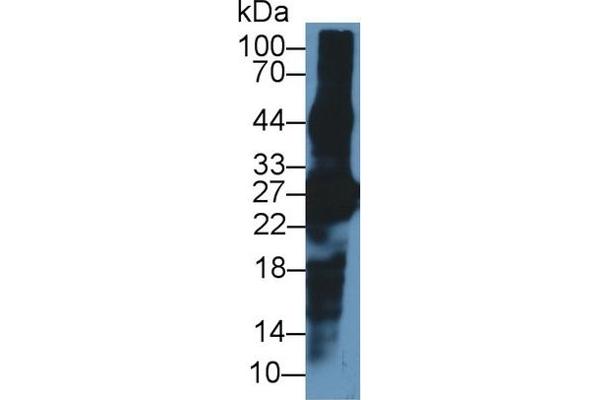 CRYBA1 antibody  (AA 1-215)