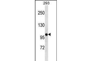 Kv2.2 antibody  (N-Term)