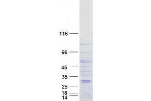 Image no. 1 for Bestrophin 3 (BEST3) (Transcript Variant 2) protein (Myc-DYKDDDDK Tag) (ABIN2715225)