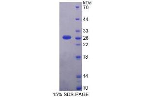Image no. 1 for Calcium Homeostasis Endoplasmic Reticulum Protein (CHERP) (AA 1-186) protein (His tag) (ABIN6239587)