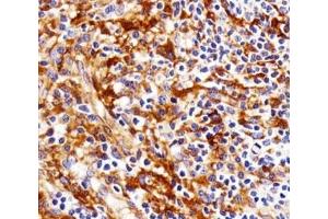 Image no. 7 for anti-FYN Oncogene Related To SRC, FGR, YES (FYN) antibody (ABIN3031012)