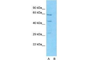 Image no. 5 for anti-Solute Carrier Family 27 (Fatty Acid Transporter), Member 2 (SLC27A2) (N-Term) antibody (ABIN2781594)