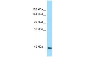 Image no. 1 for anti-Dystrophin Related Protein 2 (DRP2) (Middle Region) antibody (ABIN2789879)
