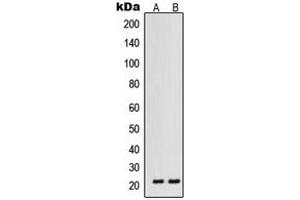 Image no. 2 for anti-Vascular Endothelial Growth Factor B (VEGFB) (Center) antibody (ABIN2707243)