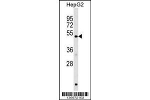 Image no. 1 for anti-Homocysteine-Inducible, Endoplasmic Reticulum Stress-Inducible, Ubiquitin-Like Domain Member 1 (HERPUD1) (AA 55-83), (N-Term) antibody (ABIN1539462)