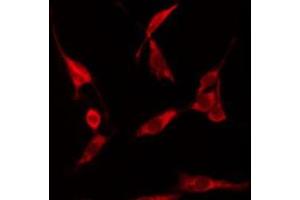Image no. 4 for anti-Heat Shock Protein 90kDa alpha (Cytosolic), Class A Member 1 (HSP90AA1) (C-Term) antibody (ABIN6262402)