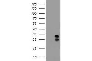 Image no. 2 for anti-Palmitoyl-Protein Thioesterase 1 (PPT1) (AA 100-306) antibody (ABIN1490801)