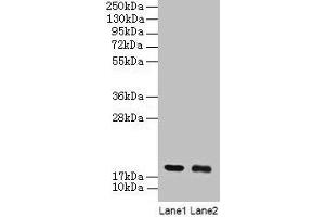 Western blot All lanes: UBE2I antibody at 2 μg/mL Lane 1: 293T whole cell lysate Lane 2: EC109 whole cell lysate Secondary Goat polyclonal to rabbit IgG at 1/15000 dilution Predicted band size: 19 kDa Observed band size: 19 kDa