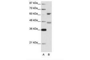 Image no. 1 for anti-Regulatory Factor X 4 (RFX4) (AA 352-401) antibody (ABIN203209)