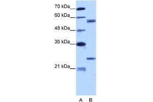 Image no. 1 for anti-Copine I (CPNE1) (N-Term) antibody (ABIN2778880)