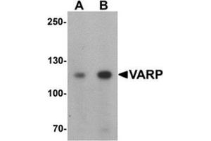 Image no. 1 for anti-Ankyrin Repeat Domain 27 (VPS9 Domain) (ANKRD27) (N-Term) antibody (ABIN1450167)