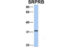 Image no. 2 for anti-Signal Recognition Particle Receptor, B Subunit (SRPRB) (Middle Region) antibody (ABIN2783830)