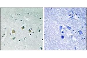 Image no. 1 for anti-Mitogen-Activated Protein Kinase Kinase Kinase 8 (MAP3K8) (AA 366-415), (pSer400) antibody (ABIN1532057)