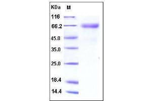 Image no. 1 for Interleukin 12 alpha (IL12A) (AA 1-219), (Subunit p35) protein (Fc Tag) (ABIN2001928)