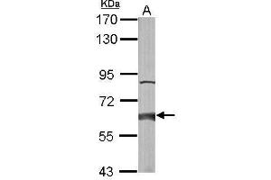 Image no. 4 for anti-2-Hydroxyacyl-CoA Lyase 1 (HACL1) (C-Term) antibody (ABIN2856448)
