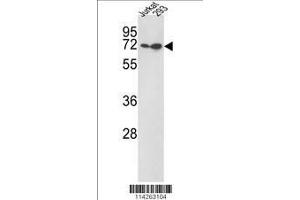 Image no. 1 for anti-Kruppel-Like Factor 4 (Gut) (KLF4) (AA 69-101) antibody (ABIN389187)