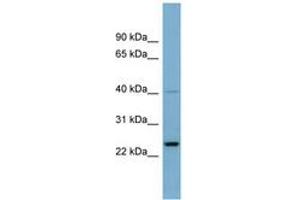 Image no. 1 for anti-Nucleolar Protein 16 (NOP16) (AA 71-120) antibody (ABIN6741999)