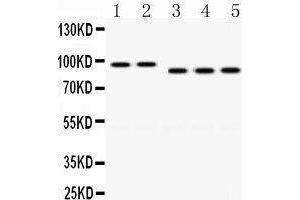 Image no. 3 for anti-Discs, Large Homolog 4 (Drosophila) (DLG4) (AA 581-724) antibody (ABIN3043563)