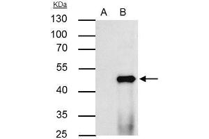 IP Image PPAR alpha antibody immunoprecipitates PPAR alpha protein in IP experiments.