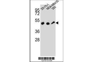 Image no. 1 for anti-Zinc Finger Protein 30 (ZFP30) (AA 65-94), (N-Term) antibody (ABIN657359)