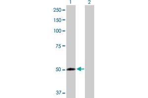 Image no. 1 for anti-Flavin Containing Monooxygenase 2 (Non-Functional) (FMO2) (AA 1-471) antibody (ABIN515767)