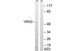 Image no. 1 for anti-Vaccinia Related Kinase 2 (VRK2) (AA 171-220) antibody (ABIN1535349)
