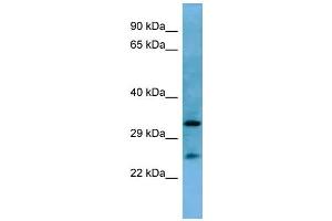 Image no. 1 for anti-Homeobox A6 (HOXA6) (N-Term) antibody (ABIN2779766)