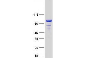 Image no. 1 for BMX Non-Receptor Tyrosine Kinase (BMX) (Transcript Variant 2) (Active) protein (Myc-DYKDDDDK Tag) (ABIN2715316)