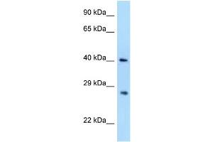 Image no. 1 for anti-Axin Interactor, Dorsalization Associated (AIDA) (N-Term) antibody (ABIN2789359)