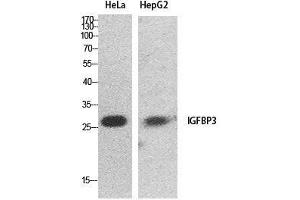 Image no. 4 for anti-Insulin-Like Growth Factor Binding Protein 3 (IGFBP3) (Internal Region) antibody (ABIN3187991)