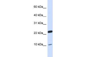 Image no. 1 for anti-TAF13 RNA Polymerase II, TATA Box Binding Protein (TBP)-Associated Factor, 18kDa (TAF13) (N-Term) antibody (ABIN2783039)