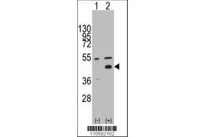 Image no. 1 for anti-WNT Inhibitory Factor 1 (WIF1) (AA 51-80), (N-Term) antibody (ABIN389184)