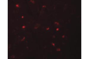 Image no. 2 for anti-NLR Family, Pyrin Domain Containing 6 (NLRP6) (N-Term) antibody (ABIN6655207)