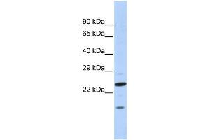 Image no. 1 for anti-Insulin Induced Gene 2 (INSIG2) (N-Term) antibody (ABIN2778637)