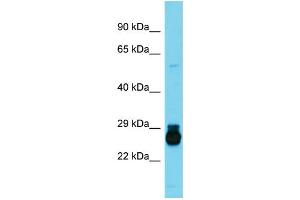 Image no. 1 for anti-Homeobox C6 (HOXC6) (Middle Region) antibody (ABIN2777248)