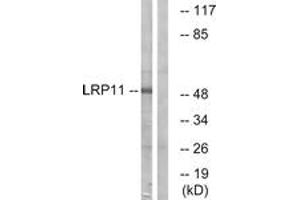 Image no. 1 for anti-Low Density Lipoprotein Receptor Related Protein 11 (LRP11) (AA 48-97) antibody (ABIN1535011)