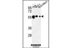Image no. 2 for anti-Tubulin, beta 1 (TUBB1) antibody (ABIN2498116)